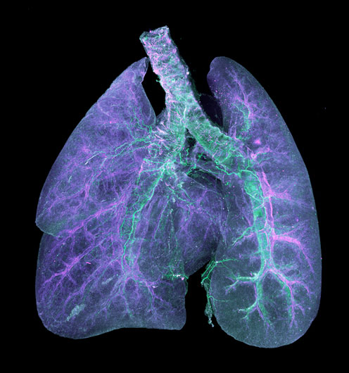 Mouse Lung